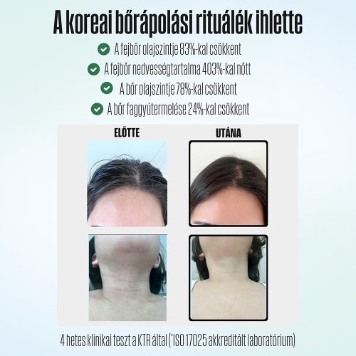 POSEION BT100® Prémium koreai revitalizáló zuhanyfej vízszűrővel, mágneses-ionizáló technológiával, szürke